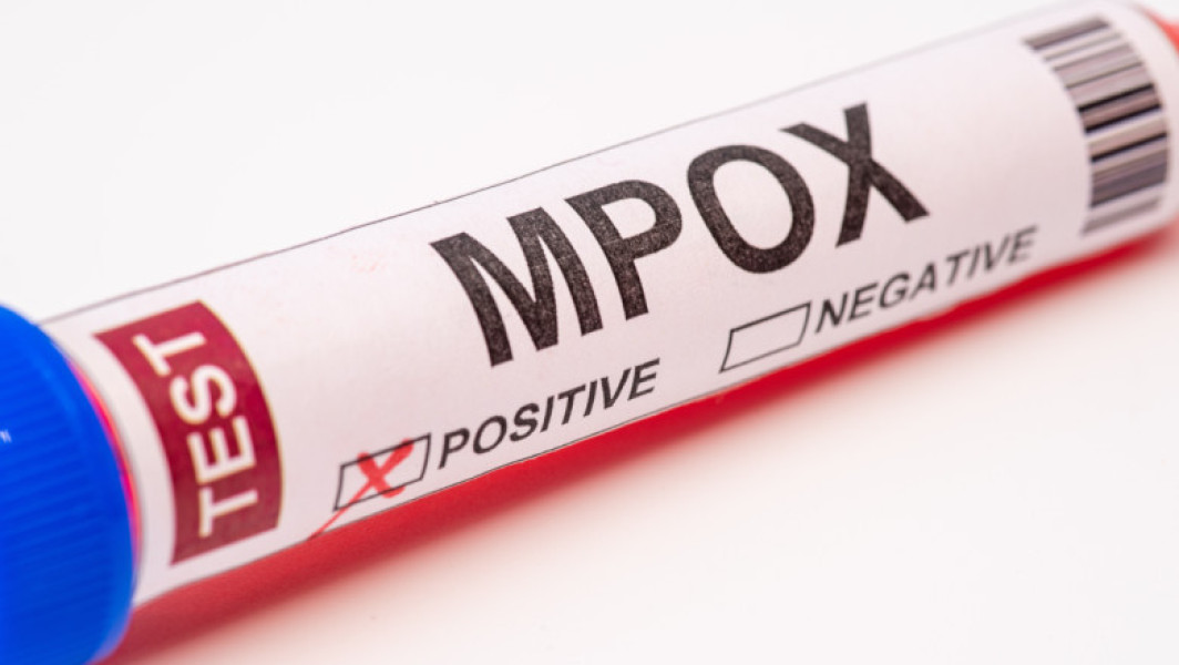 Macedonia de Nord confirmă primele cazuri de infectare cu mpox