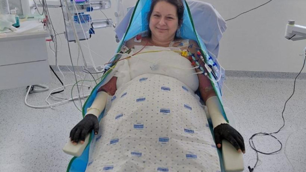 Care este starea Laviniei, pacienta cu arsuri infectată la Floreasca și transferată în Belgia. Anunţul surorii sale: „Rămâne un mister”